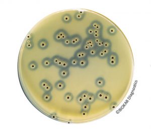 Baird-Parker Agar with egg yolk and potassium tellurite is a selective medium for the detection and enumeration of Staphylococcus aureus