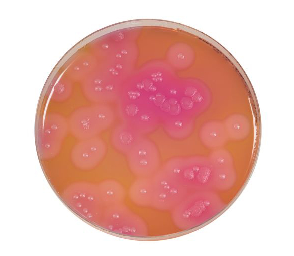 Bacillus cereus Agar is used for the detection and enumeration of spores and vegetative cells of Bacillus cereus in food products.