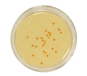 PCA supplemented with TTC and neutralizers is a media used for the detection and enumeration of microorganisms present on surfaces