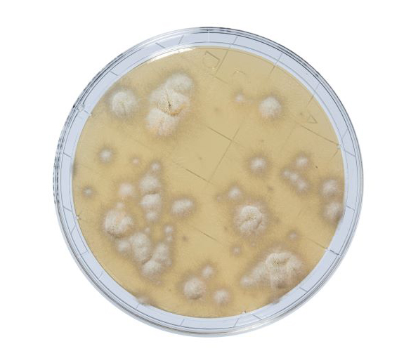 Sabouraud with Chloramphenicol Agar with neutralizers, is a media used for the detection and enumeration of yeasts and molds present on surfaces