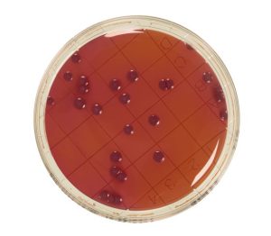 VRBG agar with neutralizers is a media used for detection and enumeration of Enterobacteriaceae, Gram - and bile salt resistant bacteria present on surfaces