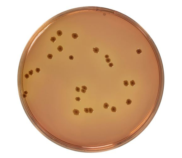 MacConkey Sorbitol agar is a selective media used for the isolation and differentiation of E. coli O157 in water, milk, beef and other food preparations.