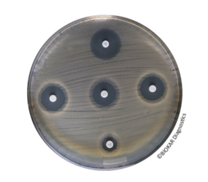 Mueller Hinton Agar is recognized by all experts as being the reference medium for the study of the susceptibility of bacteria to antibiotics and sulfamides