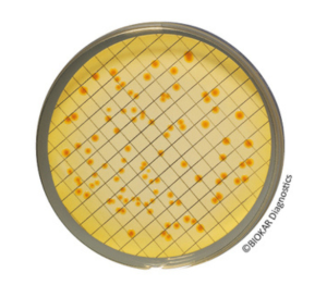 Tergitol 7 Agar is used for the enumeration of E. coli and coliform bacteria in water