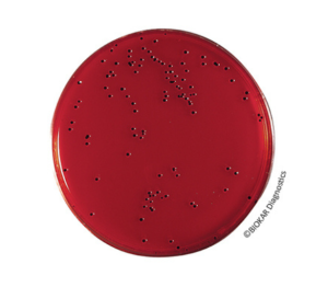 XLD Agar is used for the isolation of Salmonella in pharmaceutical products as defined in the American and European Pharmacopeia