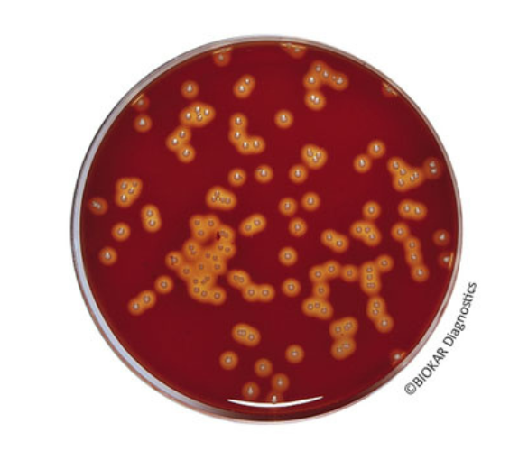 Columbia Agar is a highly nutritive medium used for the growth and isolation of a large variety of microorganisms: streptococci and pneumococci