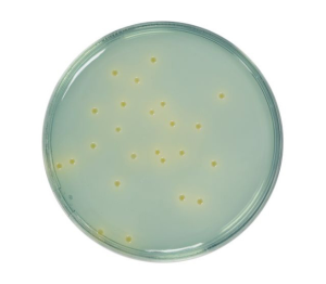 CLED (Cystine Lactose Electrolyte Deficient) agar is used for the isolation, enumeration and differentiation of urinary tract microorganisms.