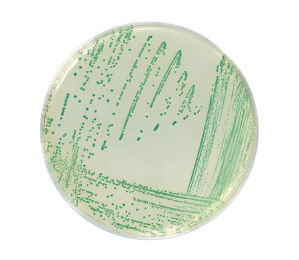 The CSD method allows the rapid detection of Cronobacter spp in human food products and products from the production environment.