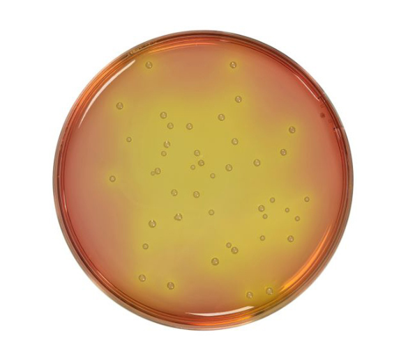 Mannitol Salt agar is used for the selective isolation, detection and enumeration of staphylococci in filterable water as in swimming pools, potable water..