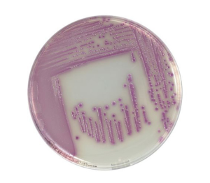 COMPASS® Salmonella Agar is a selective media allowing the isolation and differentiation of bacteria belonging to the genus Salmonella.
