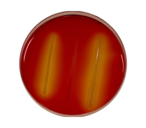 CONFIRM’ L. mono Agar® is a solid culture media designed for the confirmation of the genus & species Listeria monocytogenes