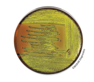 EMB Agar, originally recommended by Levine, is used to isolate and identify enterobacteria (notably E. coli and Enterobacter aerogenes)