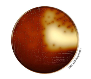KF Streptococcus Agar is a selective medium used for the isolation and enumeration of enterococci in food products by using classic enumeration techniques