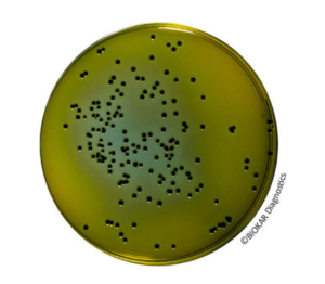 Hektoen Enteric Agar is a selective medium for the isolation and differentiation of pathogenic enterobacteria from biological samples of animal origins...