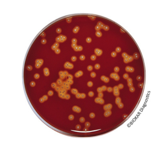 Tryptone-Soy Agar, used as a base to detect beta-hemolytic reactions and to favor the growth of aerobic and anaerobic bacteria.