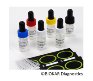 Test d'agglutination au latex pour la confirmation des legionella