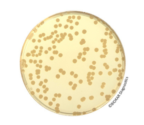 Trypto Casein-Soy Agar corresponds to the reference medium used for the evaluation of productivity and selectivity criteria of the ISO 11133 standard.